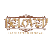Beloved Laser Tattoo Removal