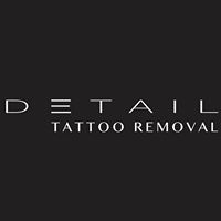 Detail Tattoo Removal Specialist