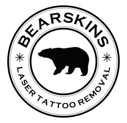 Bearskins Laser Tattoo Removal