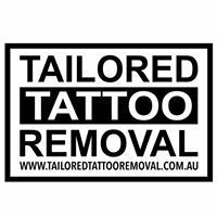 Tailored Tattoo Removal