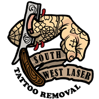 South West Laser, Tattoo Removal