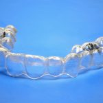 Invisalign Clear Braces San Jose CA